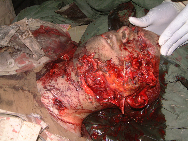 War in Iraq. Victim of war