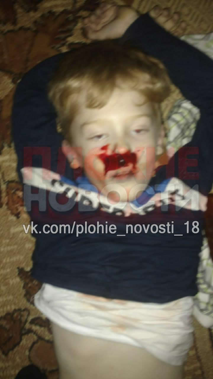 The corpse of 9-year-old Dima Makarov