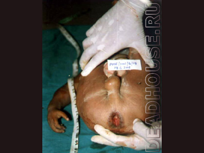 The corpse of a raped 14-month-old boy