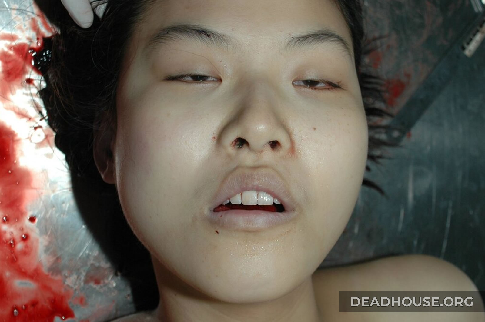 Beautiful face of a dead girl