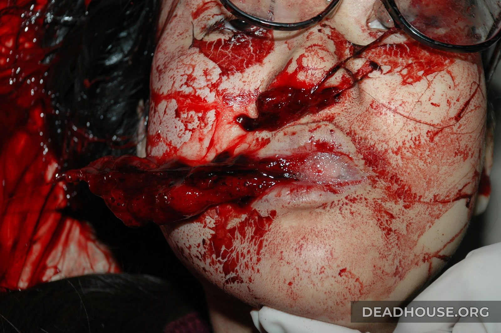 Girl's bloodied face