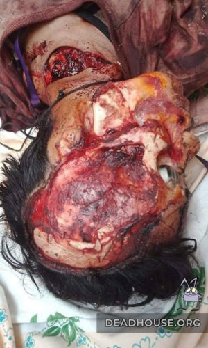 The head of a corpse with a trace of a cut in the neck