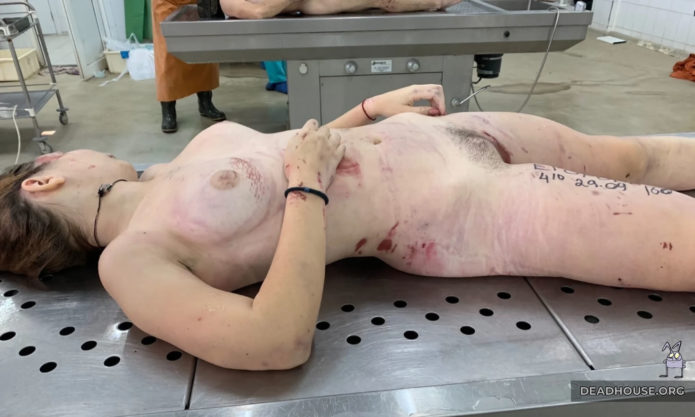 Naked corpse of a girl in a morgue