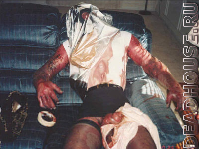 Corpse. Death caused by adhesive vapor intoxication
