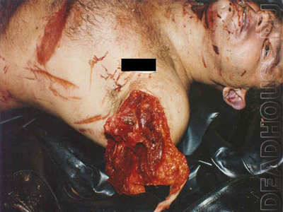 Mutilated corpses