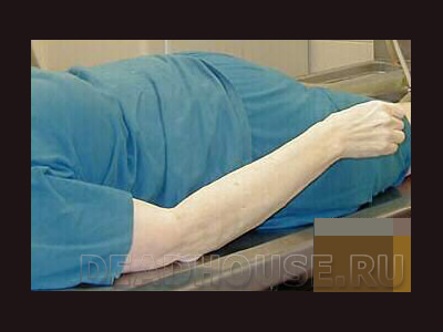 The corpse of a woman. Autopsy in the morgue