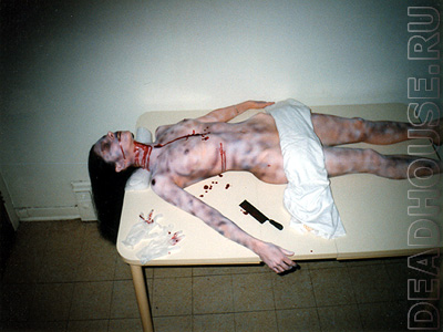 The corpse of a raped woman in a morgue