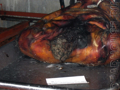 Headless corpse in the morgue