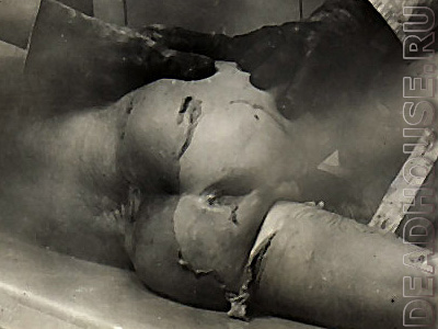 Corpse of a boy in a morgue