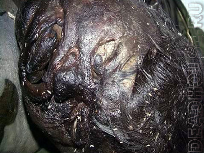 Partially decomposed corpse of a woman in a morgue