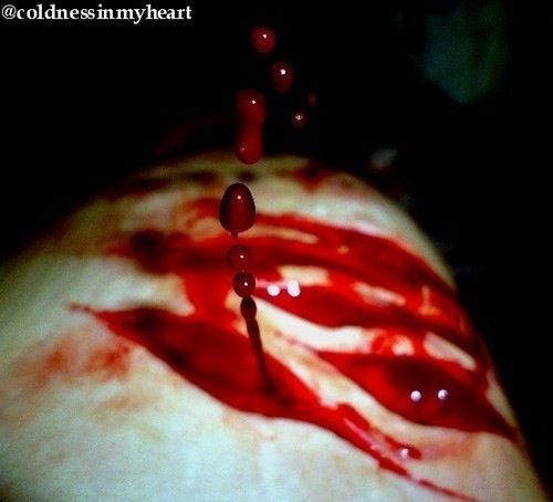 Blood drips from the wound