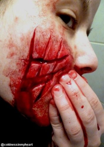 Cuts on the face
