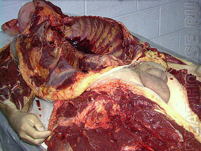 Autopsy of the corpse in the morgue
