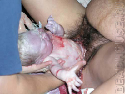 Childbirth at home