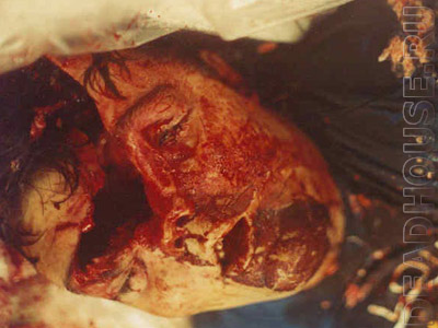 The corpse of a suicide. Head shot