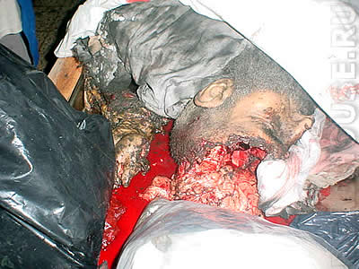 Palestine. Victim of Israeli bombing