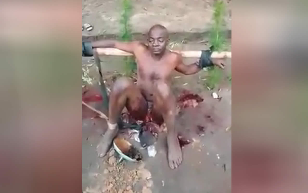 Man with severed genitals. Castration