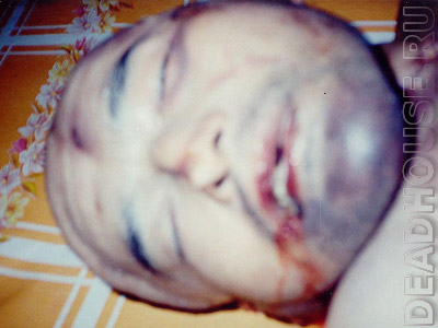 This man died from torture in a prison in Uzbekistan