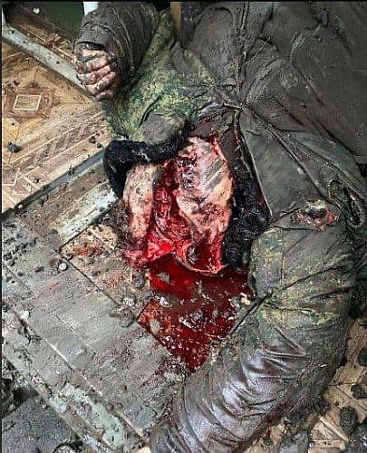 Russian soldier lost his brain